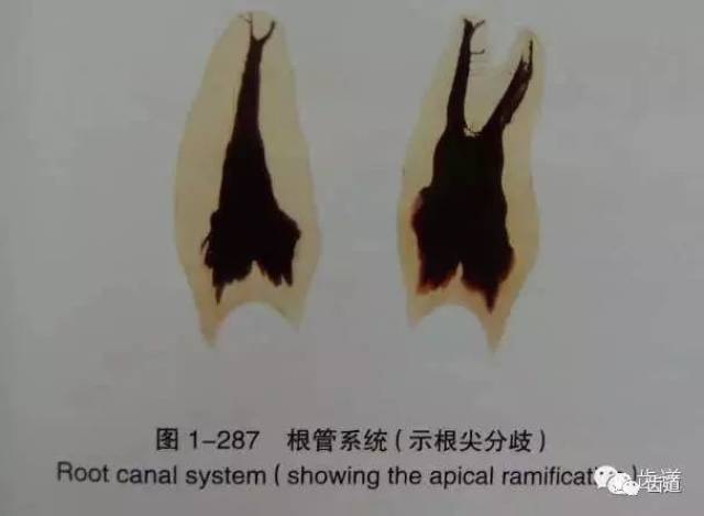 送给准备及刚当牙医的您:牙体解剖生理之牙髓腔各部名称及形态(三)