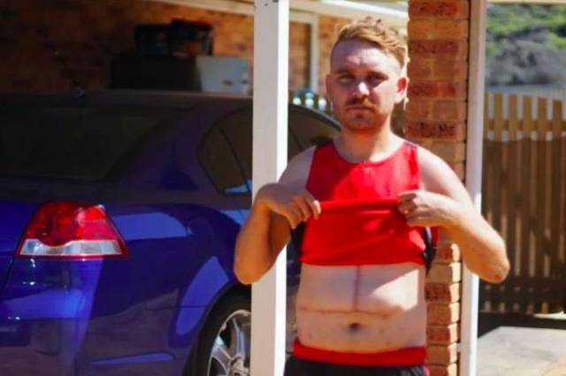 澳媒曝光!多款常吃的保健品里竟含有重金属及提取物!导致多人肝脏衰竭