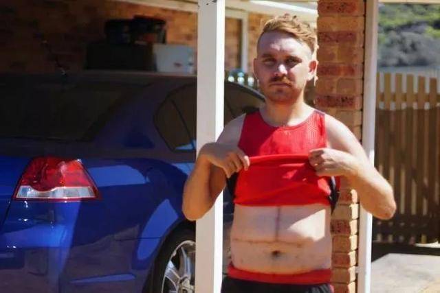 澳洲保健品重金属污染 多人肝衰竭!快看家里吃的有没有这个成分