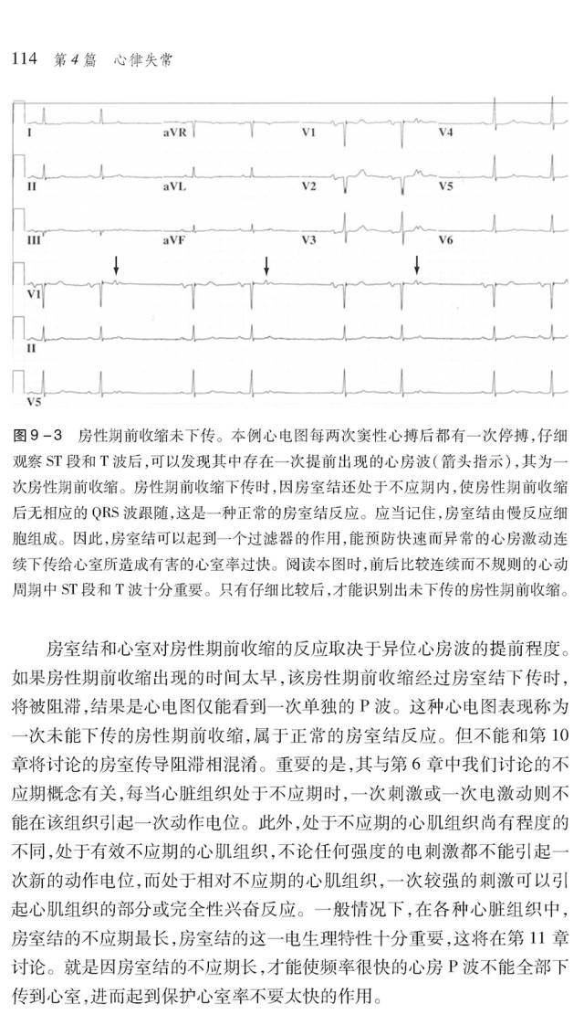 一本与众不同的心电图专著——《心电图解析:从病理生理到临床应用》