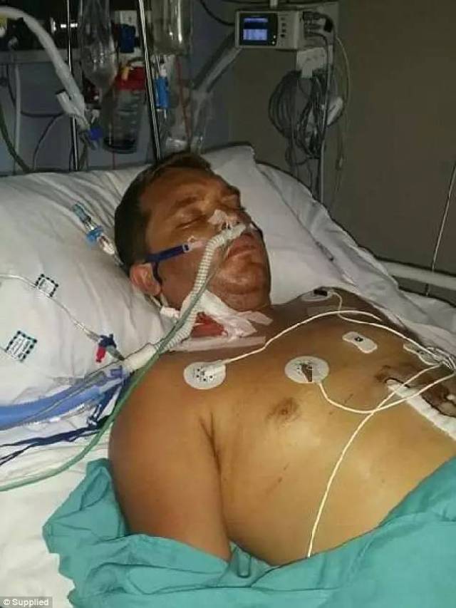 事态升级!澳洲保健品重金属污染!多人肝衰竭!快看看家里吃的有没有这个成分!