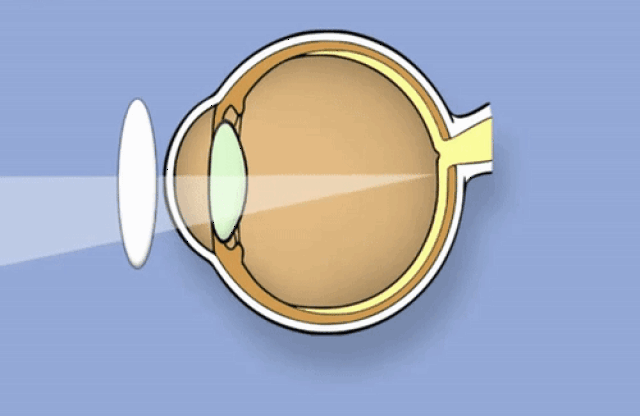 【物理揭秘】配眼镜的时候,为什么医生拿光照一照眼睛