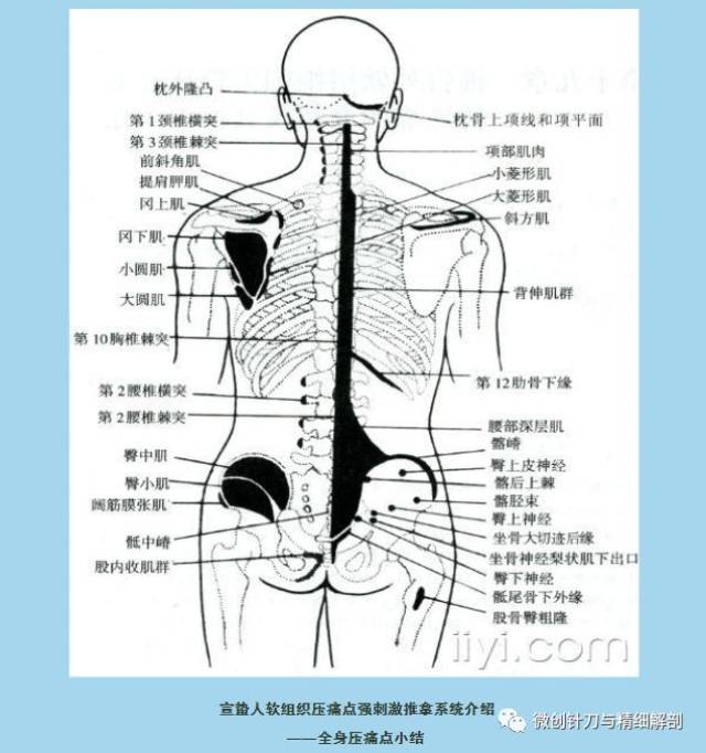 宣蛰人软组织压痛点强刺激推拿系统介绍