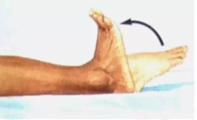 浅谈踝关节扭伤