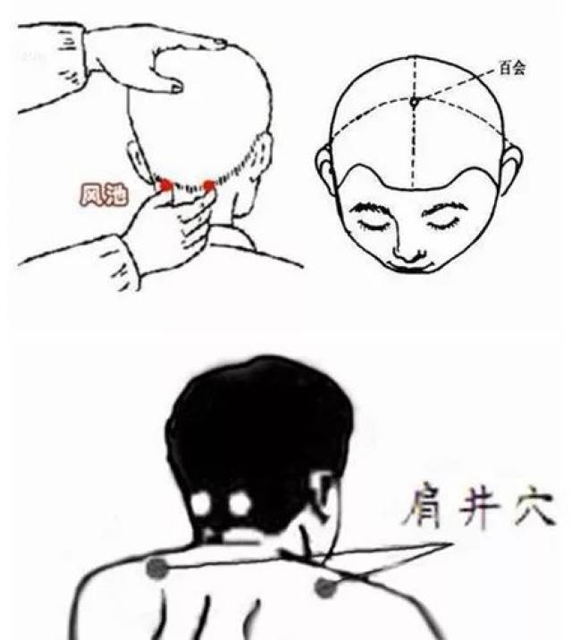 就是一种 不用扎针的 药物渗透针灸