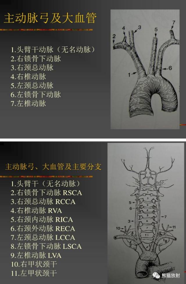 解剖丨头颈部血管