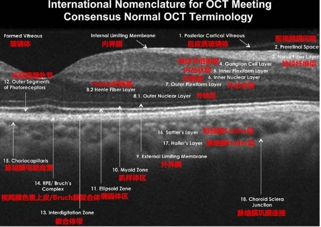 眼底oct分层,一文教你全看懂!
