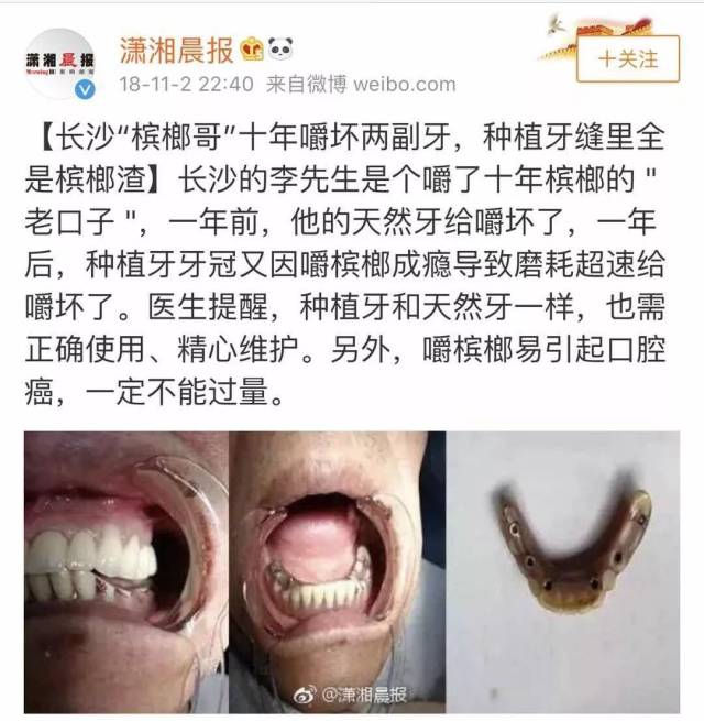 可怕的是,槟榔,在大家对它毫无防备的时候,开始无声地潜入中国各大