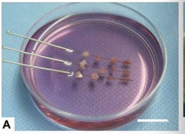 女性生育力保存之