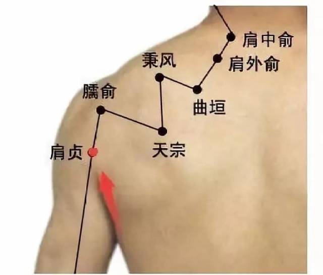 可以点按, 可以刮痧,也可以拔罐,一旦天宗穴疏通好了后,整个后背和