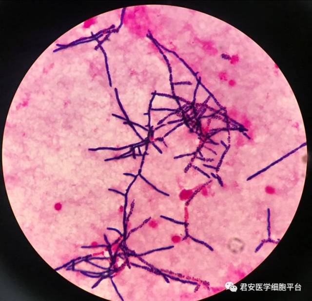 血培养报阳24h 涂片镜下表现(革兰染色)