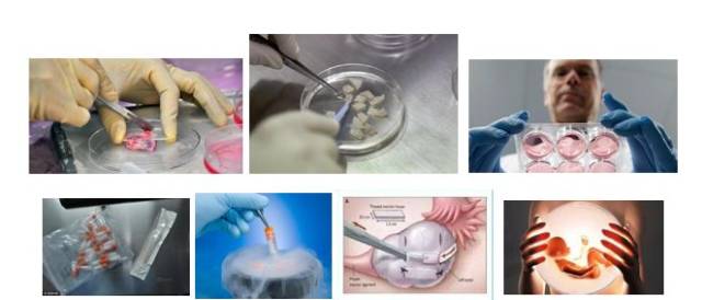 女性生育力保存之