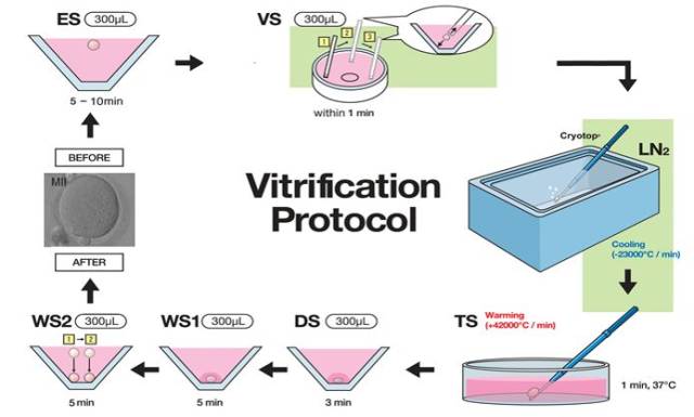 女性生育力保存之
