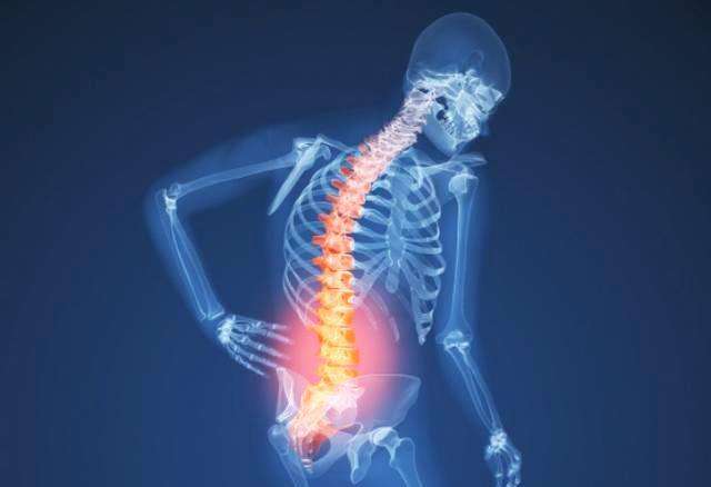强直性脊柱炎有哪些症状?有这6个表现可得小心了