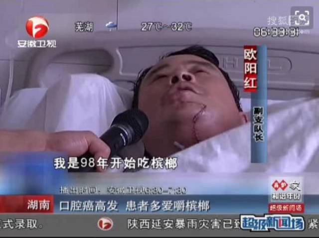 也有一些槟榔爱好者能幸免于难,但在生活质量也并不高.