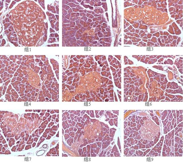 图1 正常大鼠和2型糖尿病大鼠胰腺切片