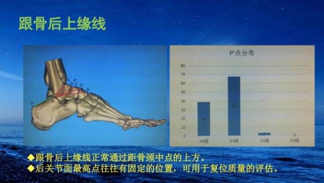 角前面的部分,中柱就是关节面部分,后柱就是结节部分,内侧柱就是关节