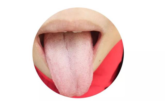 如果孩子舌质偏淡白,一般是体内有寒,或者偏于血虚,风寒感冒初期也会