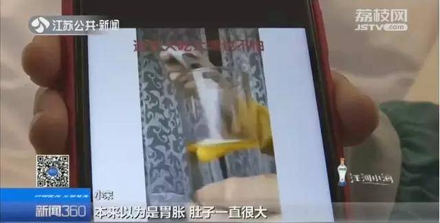 吃网红减肥代餐半个月后，紧急换肝差点搭上命