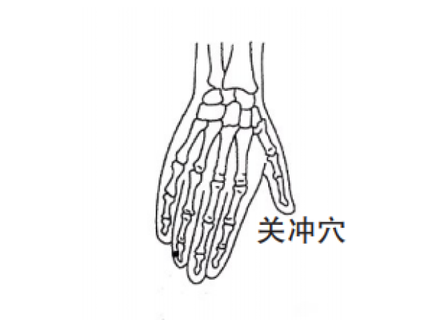 关冲穴点刺放血治疗咽喉肿痛