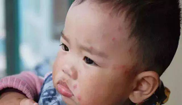 湖北人警惕！流感凶猛来袭，多地高发！出现这