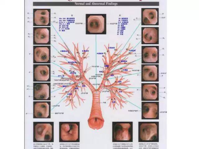 你弄懂气道支气管的解剖结构了吗?