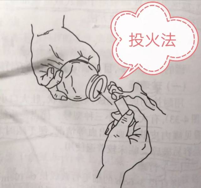 小小拔罐中的大学问!