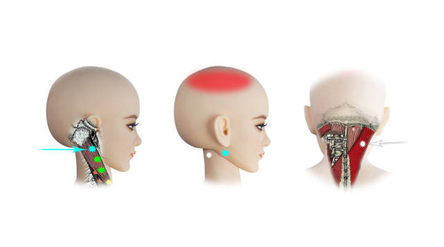 莫名其妙的头顶痛,真凶原来是.