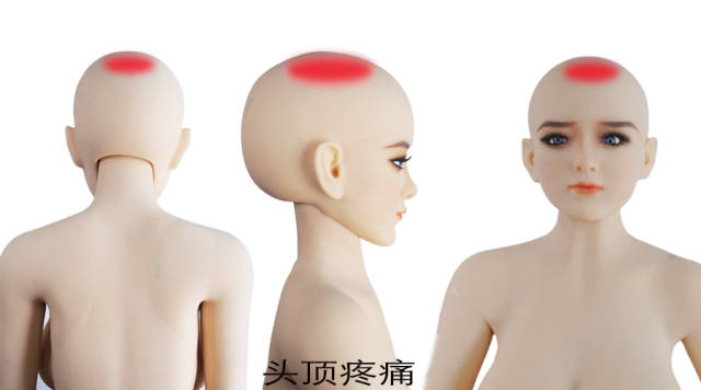 莫名其妙的头顶痛,真凶原来是.