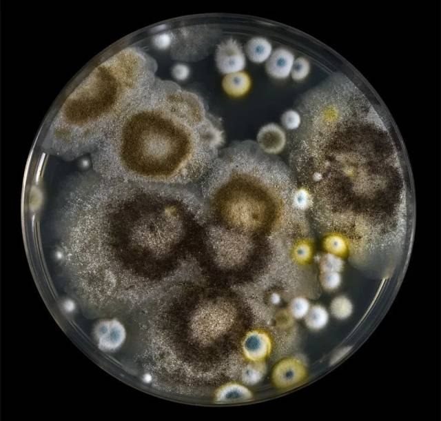 为什么霉菌感染的疾病总是不会好?医生告诉您