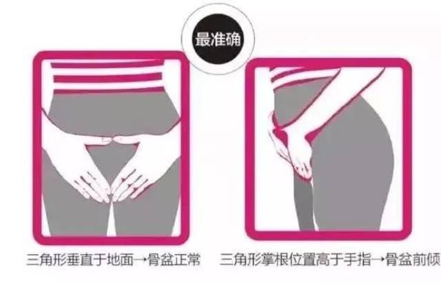 自测骨盆前倾,2招改善腰痛