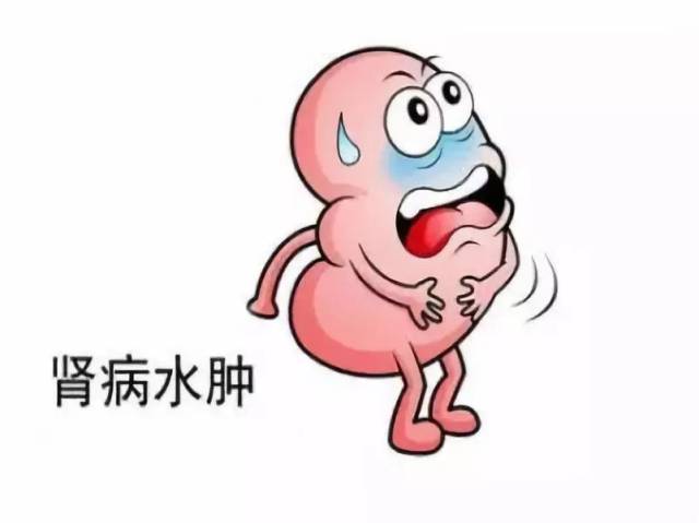 水肿:肾脏疾病的常见表现