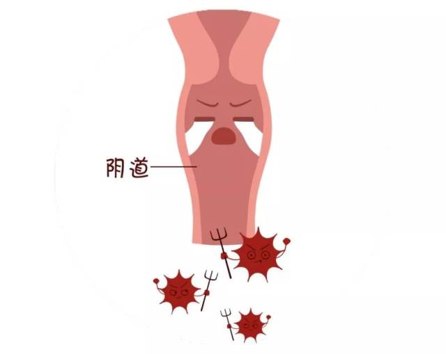 常与他的伙伴(滴虫性阴道炎)比肩并起. 特点:易卷土重来.