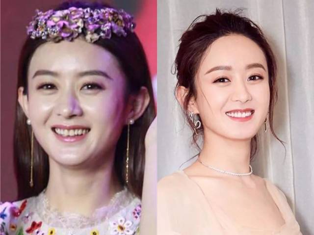 除了赵丽颖,牙黄也几乎是所有明星的颜值bug.
