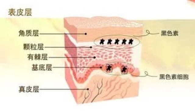 楚豫老师:色斑其实就是黑色素沉积,祛斑就要想办法去除黑色素