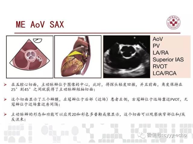 经食道超声心动图检查在儿童和成人先天性心脏病中的应用指南:美国