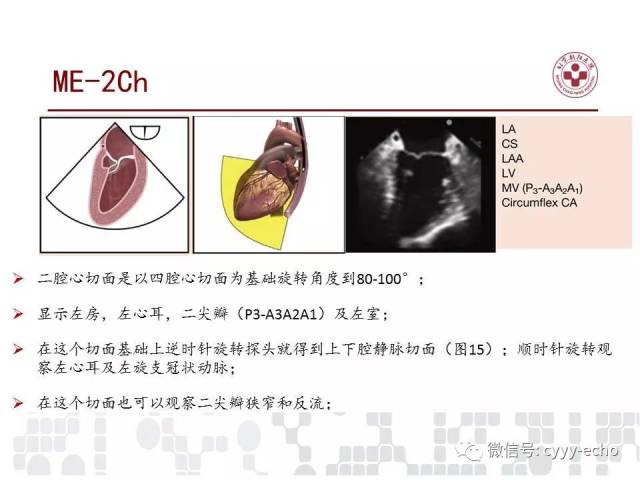 经食道超声心动图检查在儿童和成人先天性心脏病中的应用指南:美国