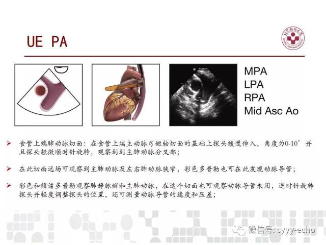 经食道超声心动图检查在儿童和成人先天性心脏病中的应用指南:美国