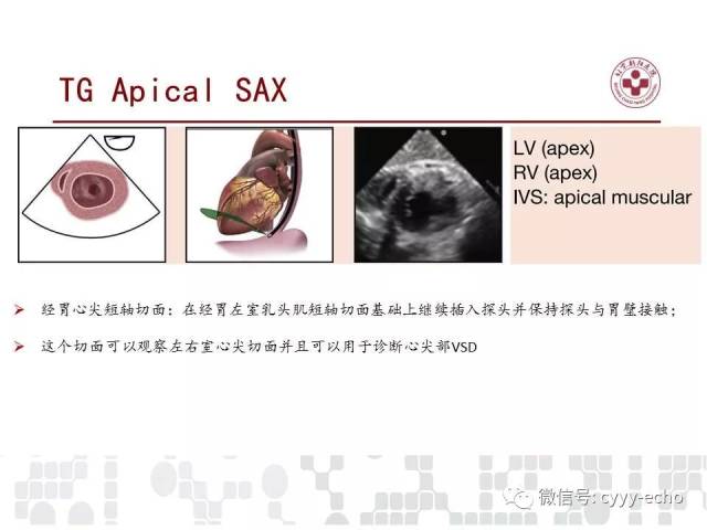 检查在儿童和成人先天性心脏病中的应用指南:美国超声心动图协会推荐