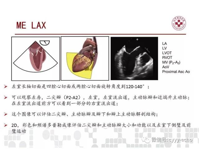 经食道超声心动图检查在儿童和成人先天性心脏病中的应用指南:美国