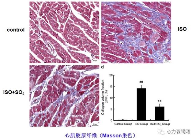 so 减轻心肌纤维化