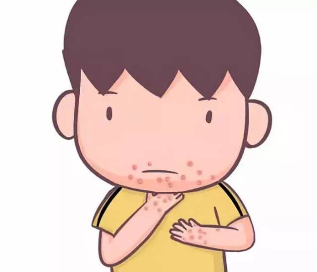 病毒疹症状及预防