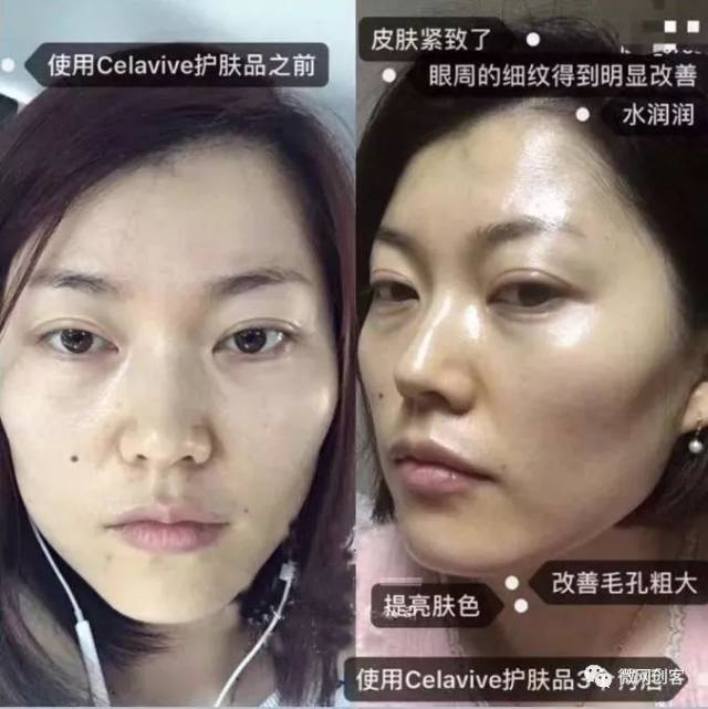 案例分享:celavive护肤品的效果让人惊叹不已