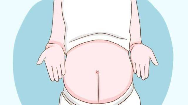 怀孕后肚皮上出现了一条黑线正常吗