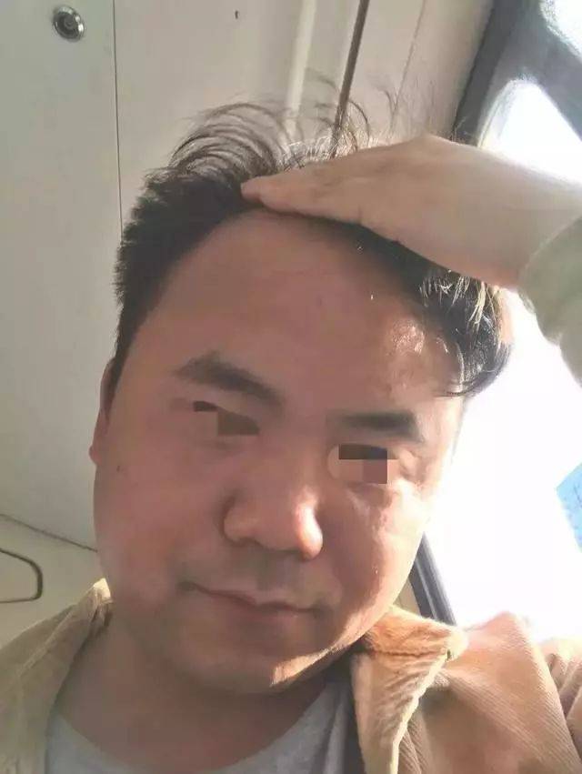 微博网友彦什么祖 这位看起来像中年大叔的男子,其实不过22岁.