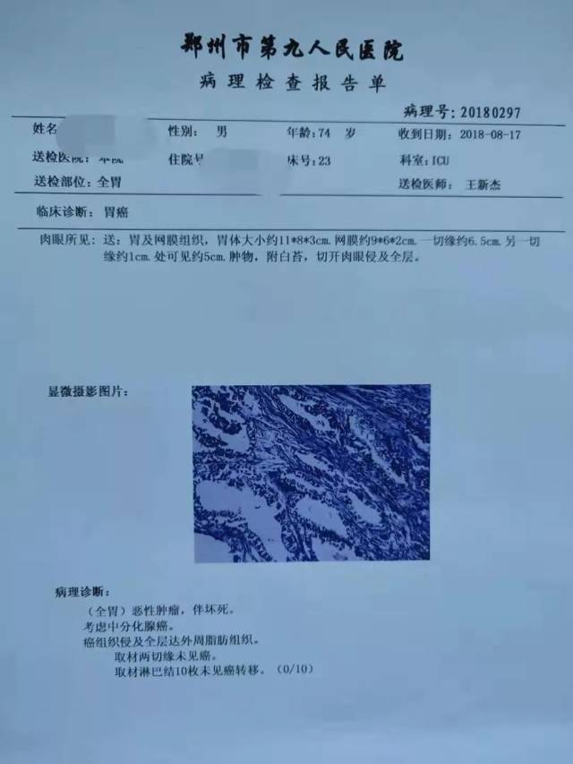 这个手术让胃癌患者能正常生活