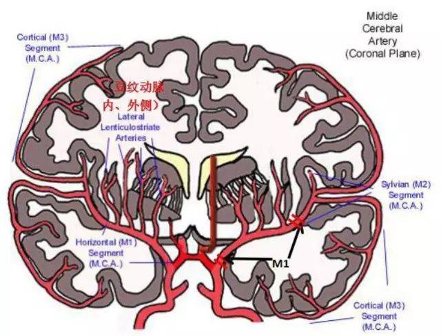 大脑中动脉分段与分支