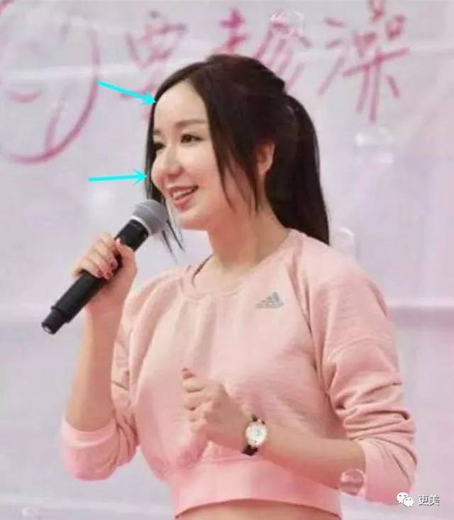 被高清镜头下的娄艺潇吓到了!跟baby同岁却肿成蔡明"亲女儿"!