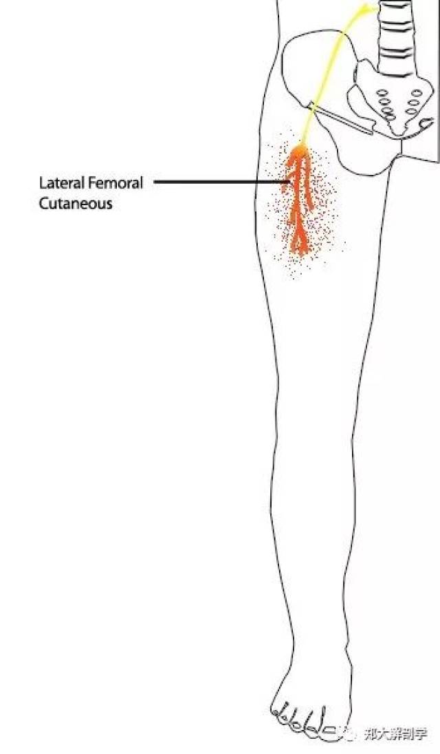 臀部疼痛的皮神经分析