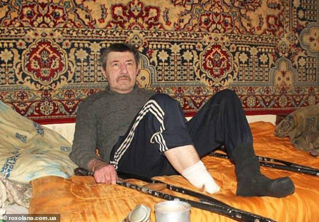 原创乌克兰男子因无钱就医在家砍掉坏脚,残肢遭狗叼走引警方谋杀调查